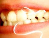 photo of a woman's mouth with dental floss tied in a bow to illustrate cavity prevention