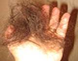 photo of clump of hair laying in a hand, looking for natural hair loss remedies
