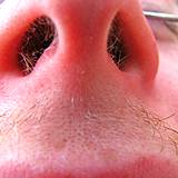 photo of a man's big nose to show how quickly pollen can enter the nose cavity and in desperate need of hay fever relief 