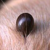photo of a tick engorged with human blood