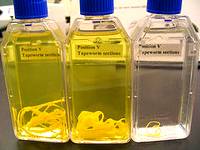 tapeworm in lab bottles