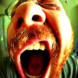 photo of a man yawning because of sleep disorder